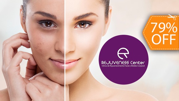 [Image: ¡Paga $30 en vez de $140 por 3 Sesiones Faciales con 3 Peelings de Ácido Láctico y Ácido Glicólico + 3 Mascarillas de Colágeno + Evaluación Profesional de la Piel y Más en Rejuveness Center!m]