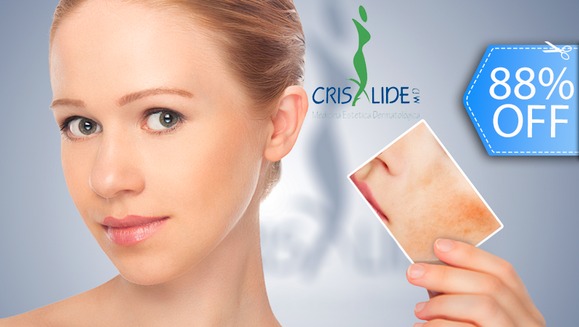 [Image: ¡Nueva Tecnología de Láser Facial! ¡Paga Q245 en lugar de Q2,100 por 2 Terapias Faciales Láser Diodo (Anti-Acné o Anti-Rosácea) + 2 Mascarillas Personalizadas + 2 Vaporizaciones de Ozono + Hidratación y Protección Solar y Más!m]