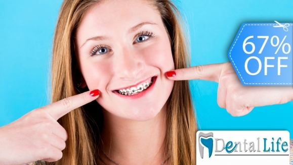 [Image: ¡Paga Q599 en vez de Q1,800 por Colocación de Brackets Metálicos (Superiores e Inferiores) + Evaluación y Diagnóstico Clínico + Profilaxis Dental + Fotografías y Modelo de Estudio!m]