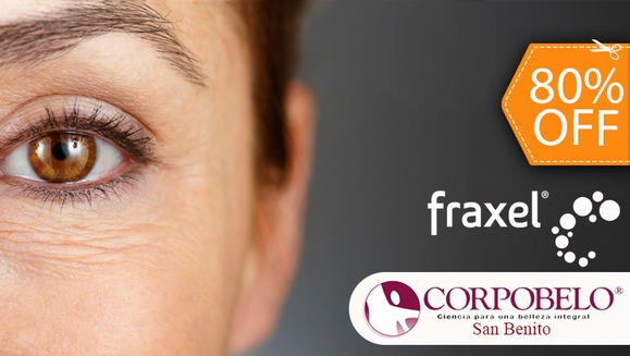 [Image: ¡Paga $99 en lugar de $485 por 1 Sesión de Láser FRAXEL para Reducción Extrema de Arrugas en Contorno de Ojos + 1 Facial de Hidratación Profunda!m]
