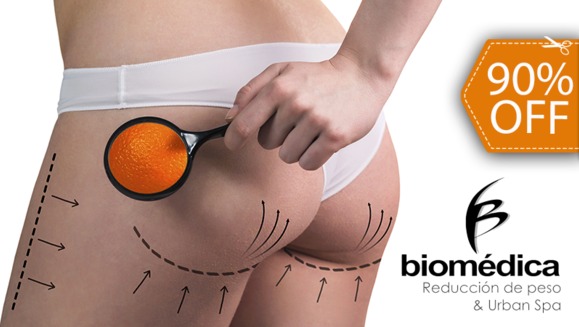 [Image: ¡Paga $29 en lugar de $300 por 35 Tratamientos Anticelulíticos para Levantamiento y Tonificación de Glúteos con: 6 Nanofrecuencias Brasileñas + 3 Maderoterapias + 3 Masajes Reductivos + 20 Shots Quema Grasa + 3 Térmicos Abdominales!m]