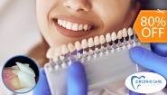 [Imagen:¡Logra una sonrisa perfecta! Paga $25 en lugar de $125 por Diseño de Sonrisa con: Carilla Dental de Resina Nano Híbrida de Porcelana y Zirconio!]