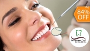 [Image: ¡Paga $9 en Lugar de $55 por Limpieza Dental con Ultrasonido + Pulido Dental + Aplicación de Flúor + Consulta y Diagnóstico + Evaluación de Cordales!m]