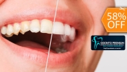 [Image: ¡Paga $50 en Lugar de $120 por 1 Aplicación de Blanqueamiento Dental Químico con Luz LED + Limpieza con Ultrasonido + Profilaxis (Pulido Dental) + Consulta Odontológica!m]