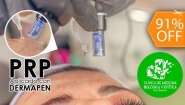 [Image: ¡Paga $30 en Lugar de $350 por Rejuvenecimiento Facial con: 1 Sesión de Plasma Rico en Plaquetas con Dermapen + 1 Microdermoabrasión con Punta de Diamante + 1 Mascarilla Natural de Miel o Pepino con Altafrecuencia!m]