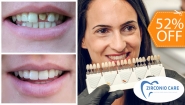 [Image: ¡Paga $60 en Lugar de $125 por Carilla Dental de Cerómero + Limpieza Dental con Ultrasonido!m]