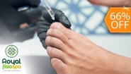 [Image: ¡Nueva Técnica! ¡Paga $45 en Lugar de $133.32 por 2 Sesiones para Eliminar Hongos Hasta en 5 Uñas que Incluye: 2 Aplicaciones de Ácido + 2 Pedicures Clínicos + Diagnóstico Profesional!m]