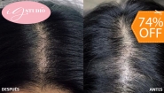 [Image: ¡Paga $65 en Lugar de $250 por Una Sesión de Microblading Capilar en el Área Frontal, Coronilla o Barba + Retoque!m]