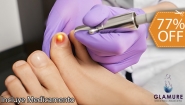 [Image: ¡La Solución Rápida para Uñas Sanas! ¡Paga $35 en Lugar de $150 y Elimina Hongos en Hasta 3 Uñas con Láser + Medicamento para Combatir la Onicomicosis (30 ml)!m]