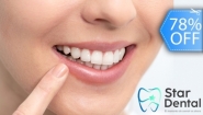 [Image: ¡Paga Q395 en Lugar de Q1,800 por Blanqueamiento Dental Químico con Luz LED + Remoción de Manchas con Profilaxis + Limpieza con Ultrasonido + Evaluación Completa con Cámara Intraoral!m]