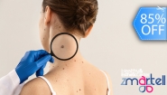 [Image: ¡Paga Q75 en Lugar de Q500 por Cauterización Láser de hasta 10 Cabezas de Vena, 4 Lunares o 4 Verrugas (de hasta 5 mm) + Evaluación Médica!m]