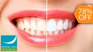 [Image: ¡Paga $50 en Lugar de $225 por Blanqueamiento Dental Químico con Luz LED + Limpieza Profunda con Ultrasonido (Detartraje) + Consulta Odontológica + Aplicación de Refuerzo y Más!m]