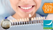 [Image: ¡Recupera tu Sonrisa! ¡Paga $78 en Lugar de $225 por 1 Corona Dental (Metal Porcelana) + Profilaxis Manual (Pulido y Limpieza) + 1 Tono de Blanqueamiento Dental!m]