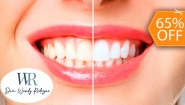 [Image: ¡Paga $55 en Lugar de $155 por 2 Aplicaciones de Blanqueamiento Dental con Luz LED + Limpieza Dental!m]
