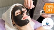 [Image: ¡Adiós Poros Dilatados! ¡Paga $19 en Lugar de $85 por Facial de Rejuvenecimiento “Hollywood Peel” con Microdermoabrasión con Punta de Diamante + Aplicación de Láser + Mascarilla de Carbón Activado + Extracción de Puntos Negros + Exfoliación y Más!m]