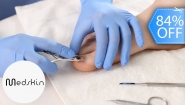 [Image: ¡Paga Q125 en Lugar de Q800 por Pedicure Médico que Incluye: Limpieza + Extracción + Aplicación de Medicamento Clínico para Uñas Encarnadas, con Onicomicosis, Hongos u Otras Afecciones + Evaluación + Instrucciones de Seguimiento!m]